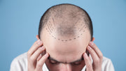 Hairline